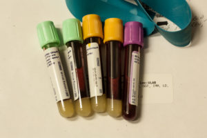 analisis sangre
